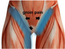 groin-pain.png